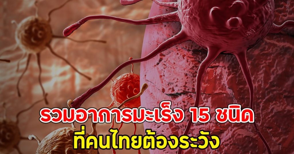 หมอเจษฎ์เตือนภัยเงียบ รวมอาการมะเร็ง 15 ชนิด ที่คนไทยต้องระวัง